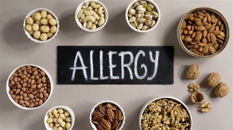Food allergies occur when the immune system reacts to certain proteins, causing symptoms ranging from mild to severe, and require careful management to avoid allergic reactions and ensure safety.